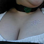 breast_crystalls